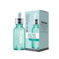 Rojukiss Acne Poreless Serum 5 ml. ѭ ǫӫҡҡ  ҡè٤