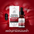 �����Ŵ����ҹ١�� Manuka Dark Spot Serum Founderskin �������ʡԹ ��Ҵ 18ml ( Exp 2028 ) �ͧ���觵ç�ҡ����ѷ